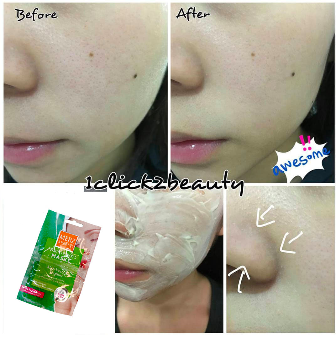 德國MERZ 蘆薈+乳酪面膜 3PACK6包 - buy European skincare in Hong Kong - 1click2beauty