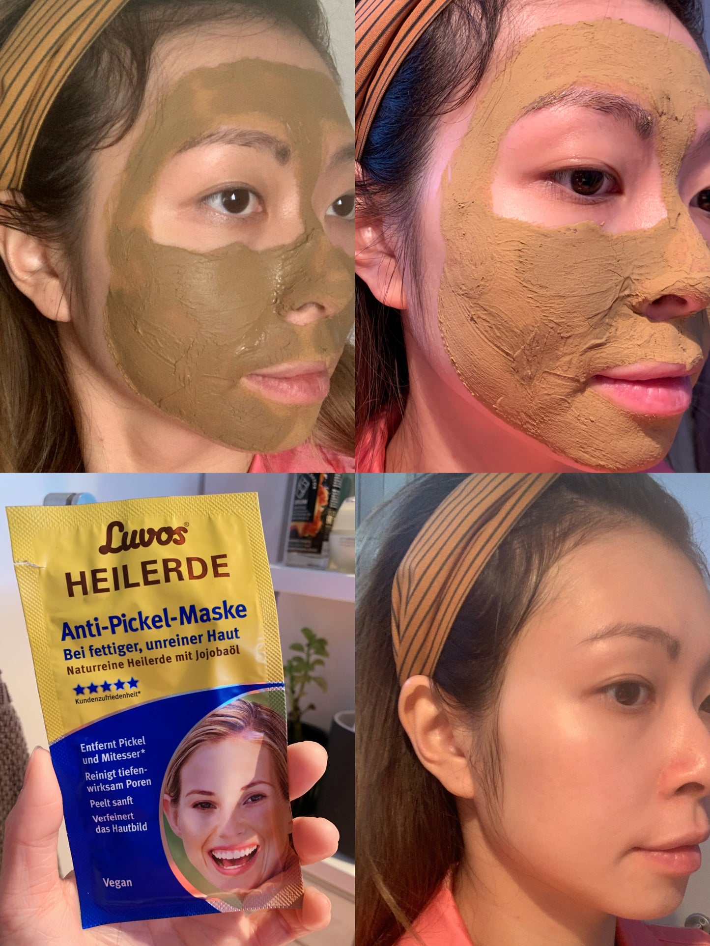 德國熱銷Luvos去黑頭抗痘消炎清潔面膜 3片