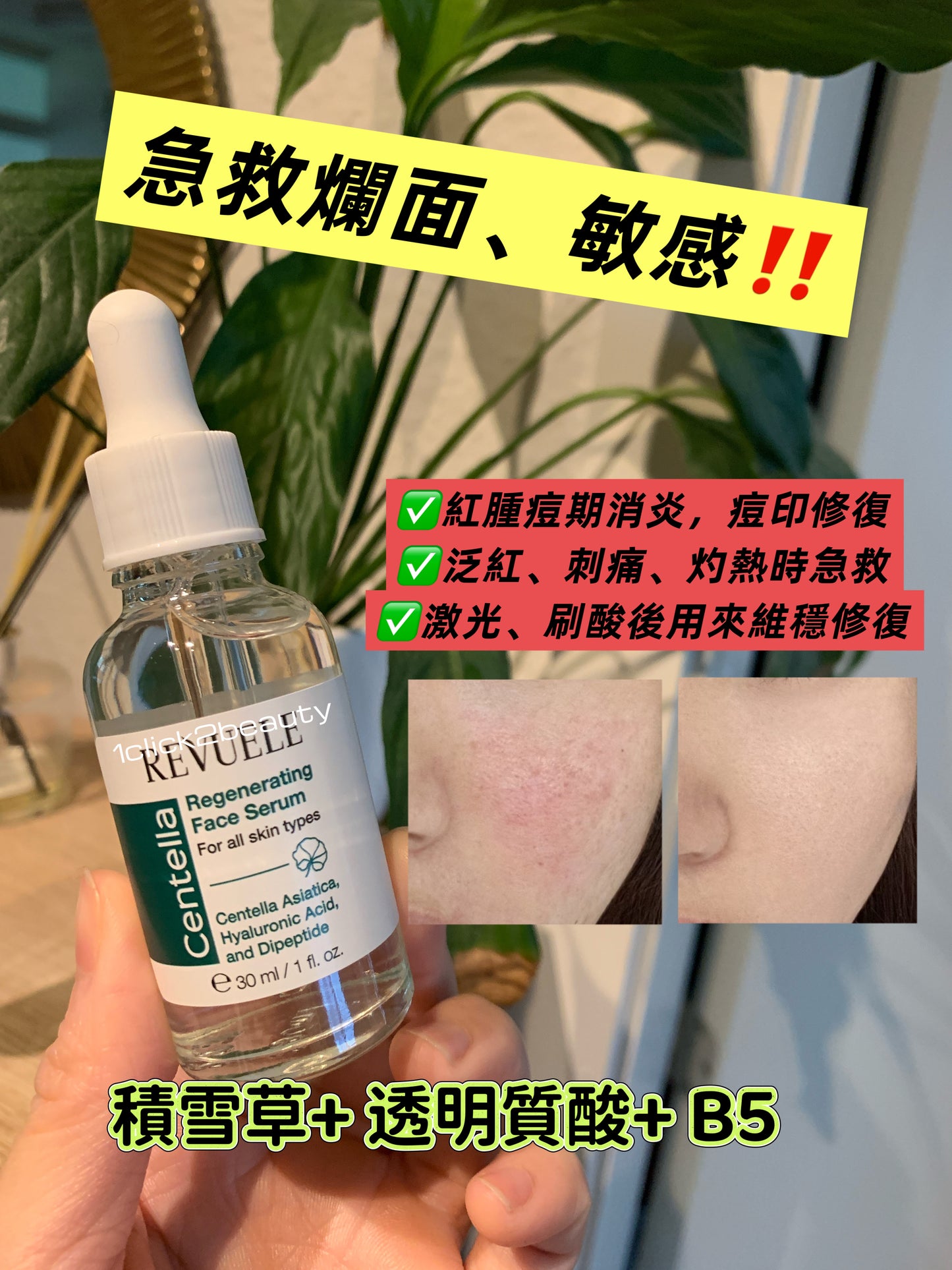 Revuele Centella Regenerating Face Serum - 舒緩修護精華，含積雪草萃取、透明質酸及維他命B5，專為敏感、泛紅及受損肌膚設計。
